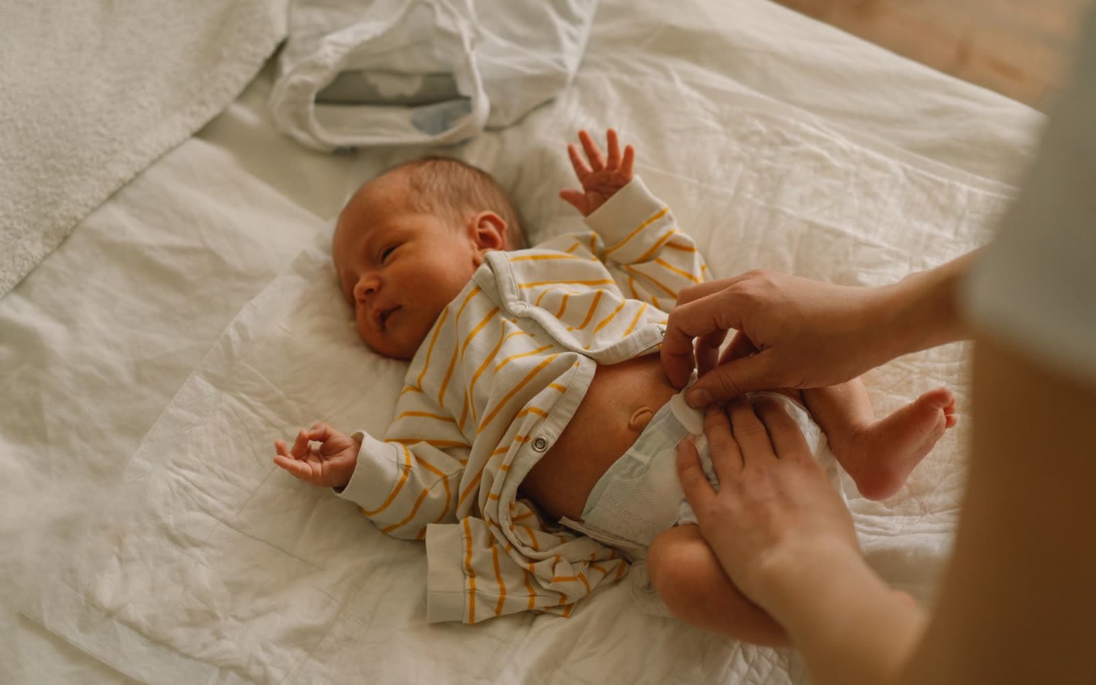 Baby being changed on a bed. Pediatric Colorectal Surgery