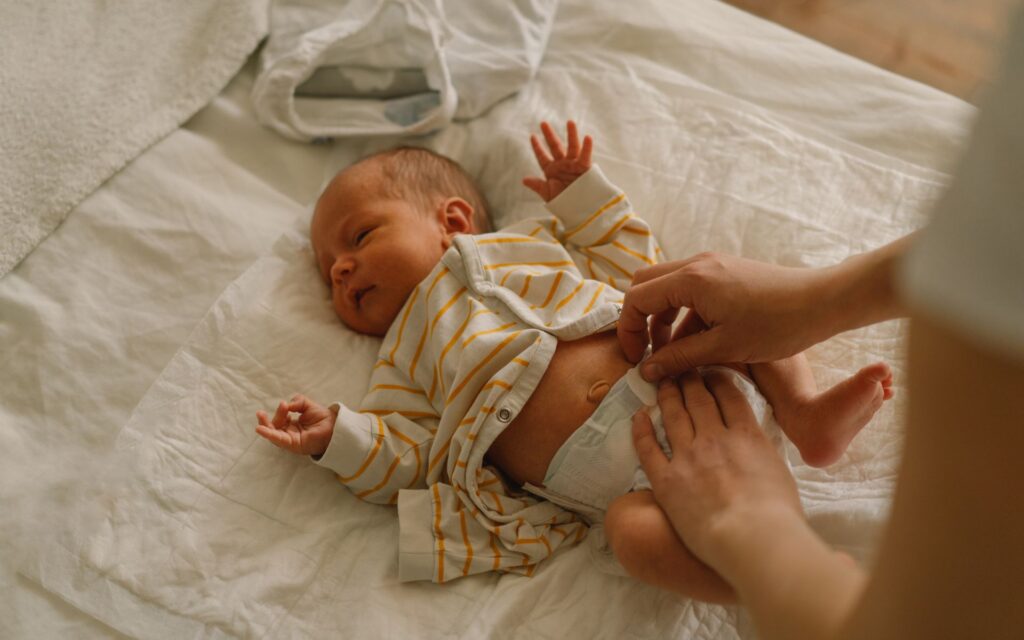 Baby being changed on a bed. Pediatric Colorectal Surgery