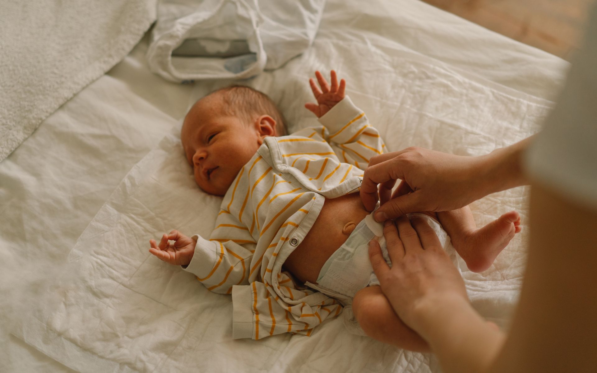 Baby being changed on a bed. Pediatric Colorectal Surgery